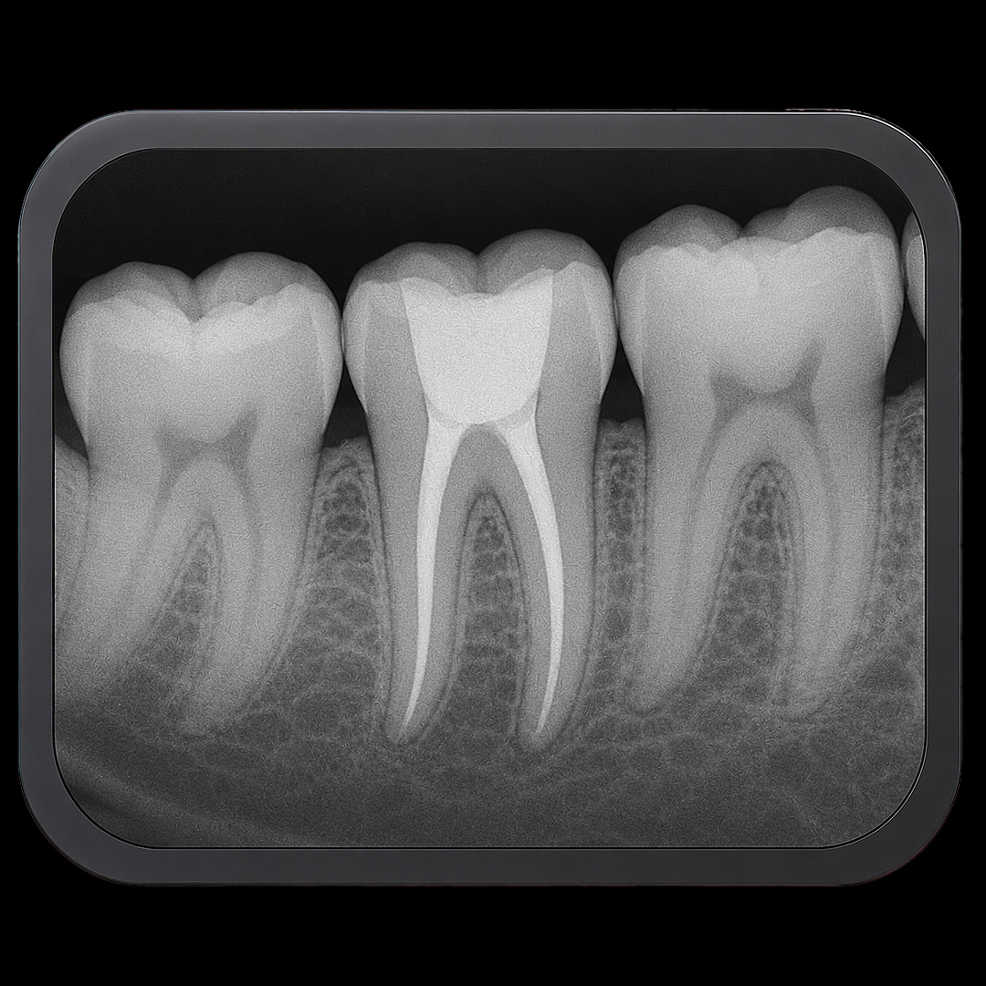 Paso 1: Estudio Periodontal de las encías