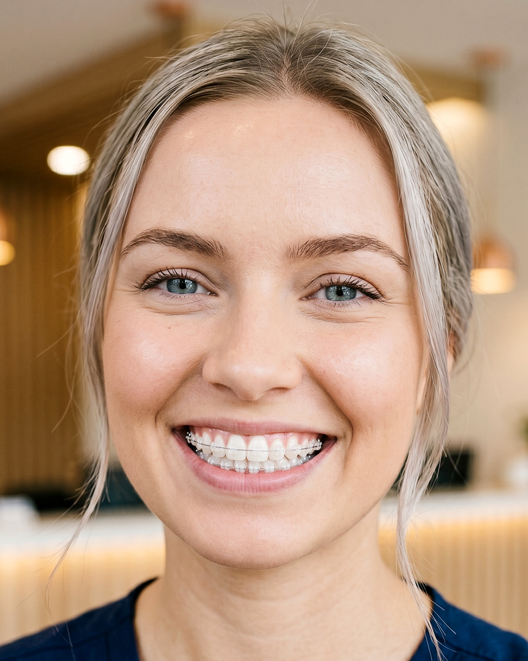 Ortodoncia estética con Brackets de Zafiro